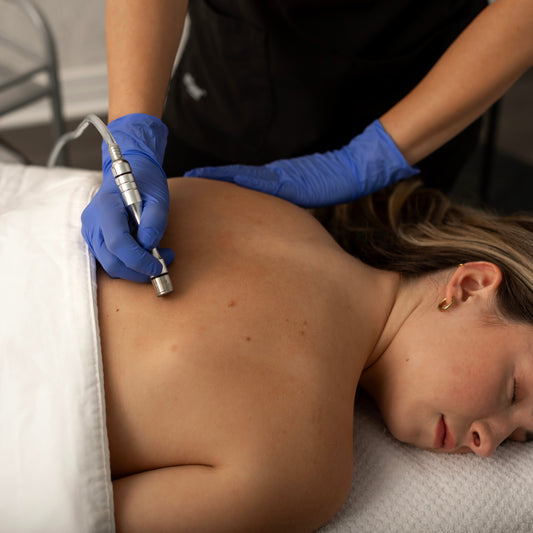 Back Acne Treatment